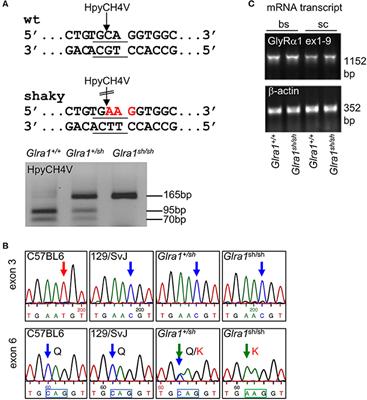 Functional Consequences of the Postnatal Switch From Neonatal to Mutant Adult Glycine Receptor α1 Subunits in the Shaky Mouse Model of Startle Disease